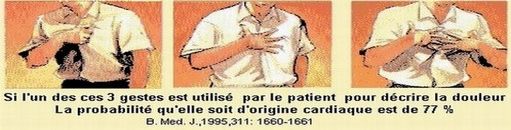 local/cache-vignettes/L511xH130/angor-d9191.jpg?1433604812